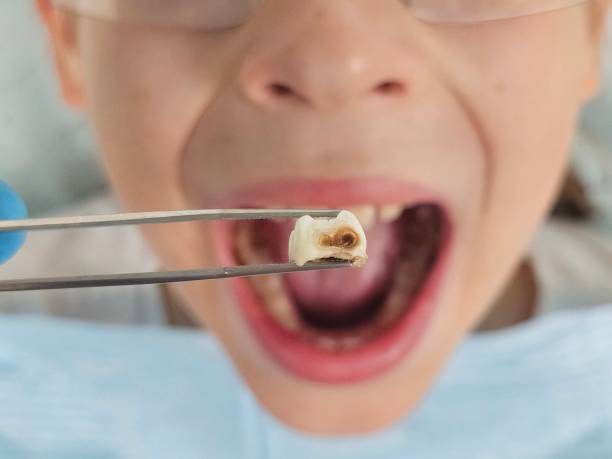 Professional Emergency Dental Service in UT
