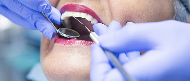Best Emergency Denture Repair in Centerville, UT